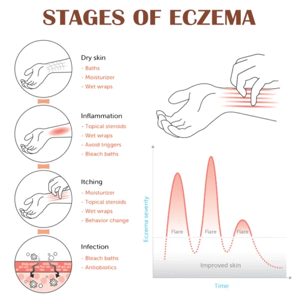 ATTDX EczemaRelief Treatment Spray - Image 8