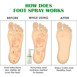 ATTDX FreshFeet Debacteria Botanical Spray