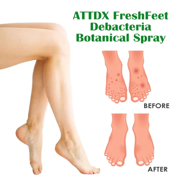 ATTDX FreshFeet Debacteria Botanical Spray