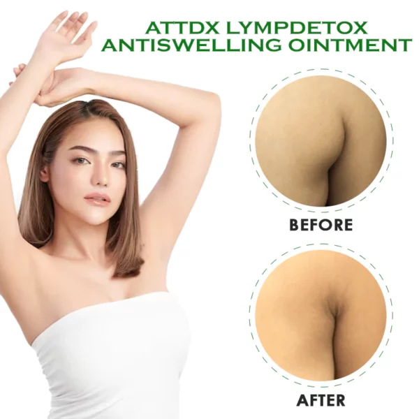 ATTDX LympDetox AntiSwelling Ointment - Image 6