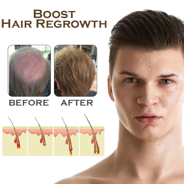 ATTDX PureGinger HairRegrowth Treatment Spray - Image 5