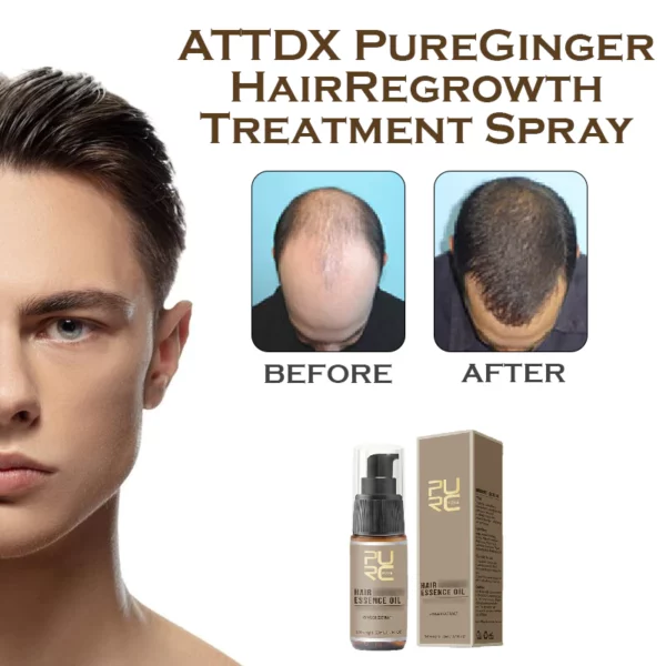 ATTDX PureGinger HairRegrowth Treatment Spray - Image 6