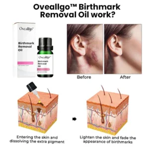 CC™ Birthmark Removal Oil