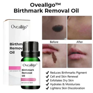 CC™ Birthmark Removal Oil