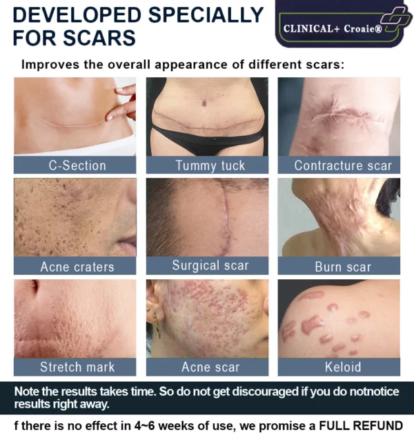 CLINICAL+ Croaie® Advanced Scar Repair Gel - Image 4