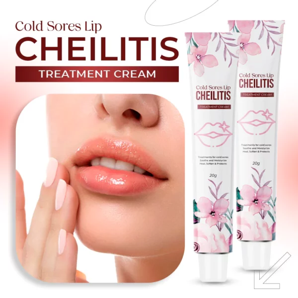 Cold Sores Lip Cheilitis Treatment Cream - Image 2