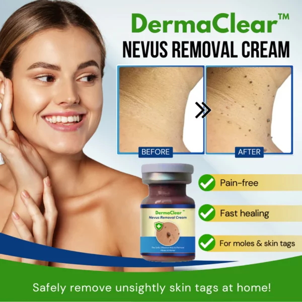 DermaClear™ Nevus Removal Cream