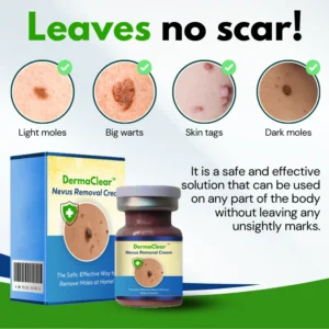 DermaClear™ Nevus Removal Cream