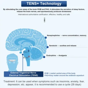 Dream™ TENS+ Headache Relief Sleep Massager