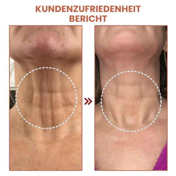 Fivfivgo™ Vita Collagen Bounce Faltenbalsam - Image 3