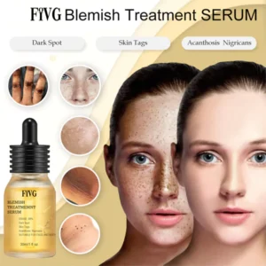 Fivg™ Blemish Treatment Serum