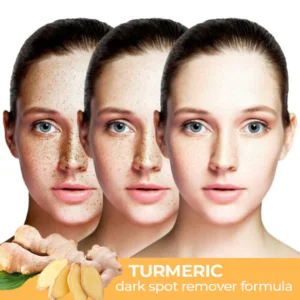 Flashing™ Spot-Off Turmeric Oil