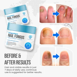 Fungus Shield Nail Treatment Cream