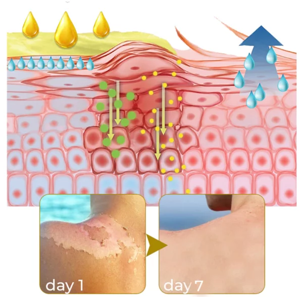 GFOUK™ Acanthosis Nigricans Peeling Oil - Image 4