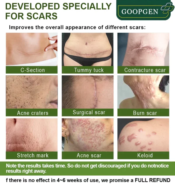 GOOPGEN™ Advanced Scar Repair Serum - Image 3