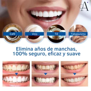 Lanthome™ Esencia blanqueadora de dientes