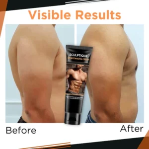 Loqam™ Gynecomastia Cream