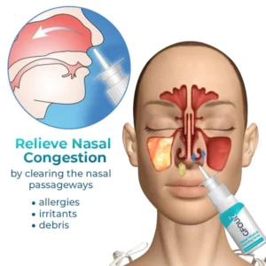 Loqam™ Nasal Mucus Cleansing Spray