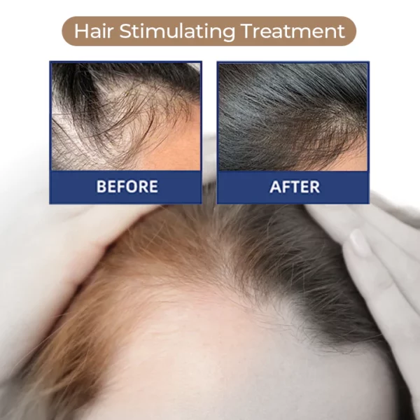 MEDix™ Hair Stimulating Spray - Image 3