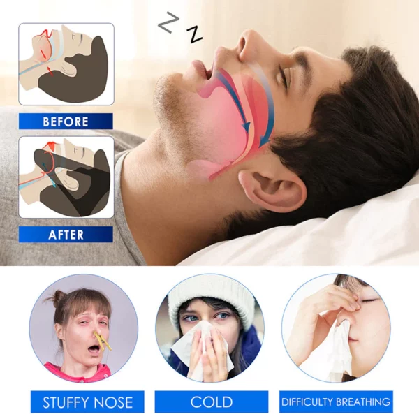 Meellop™ Anti Snoring Spray - Image 4