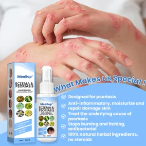 Meellop™ Herbal Psoriasis Relief Spray