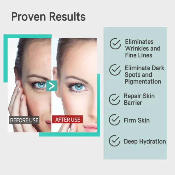 Nuves™ MMP Anti-Wrinkle Antioxidant Serum - Image 3