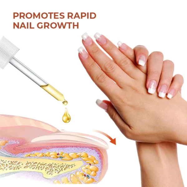 Oveallgo™ 7 Days LUX Maximum Strength Nail Repair Serum - Image 2