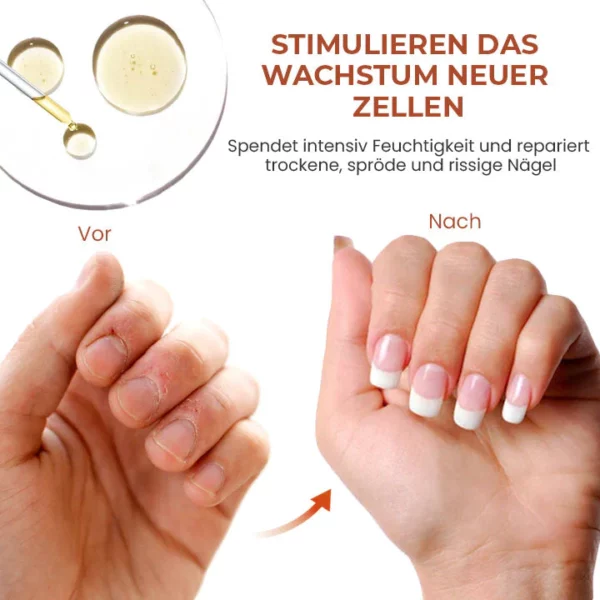 Oveallgo™ 7 Tage Maximale Stärke Nagel-Reparatur-Serum - Image 3