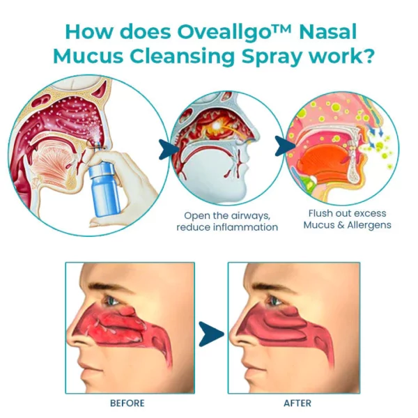 Nasal Mucus Cleansing Spray - Image 4