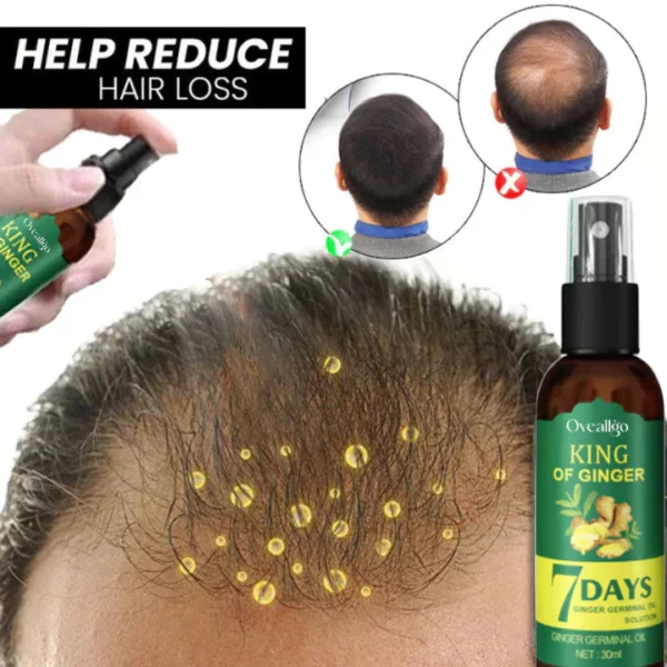 Oveallgo™ Shouga Kingu Hair Growth Oil