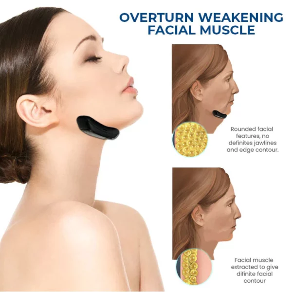 Oveallgo™ SleepBeauty Face Sculptor - Image 2