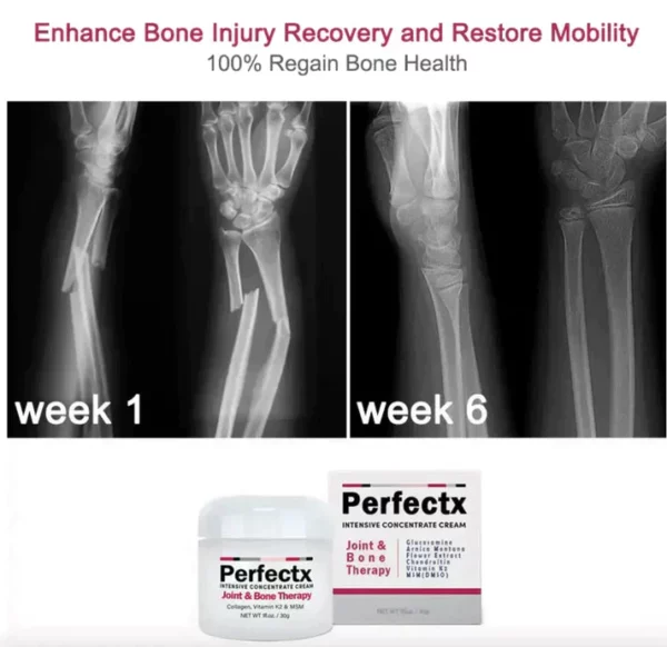 PerfectX Joint And Bone Therapy Cream - Image 2