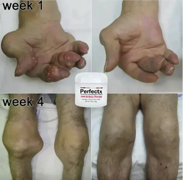 PerfectX Joint And Bone Therapy Cream - Image 3