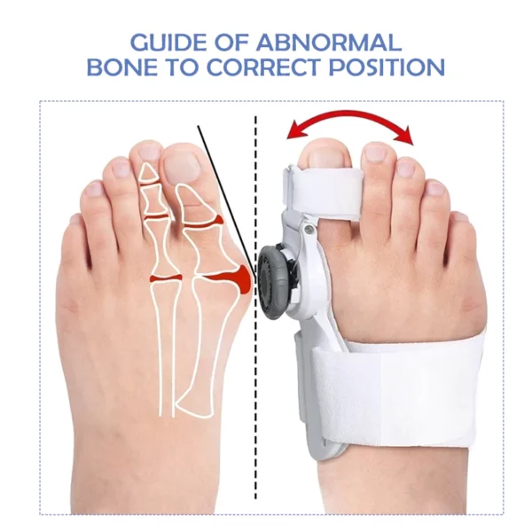 Ricpind StraightToe Adjustable BunionCorrector - Image 6