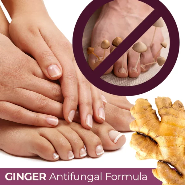 RxCARE™ Ginger Nail Treatment Essence