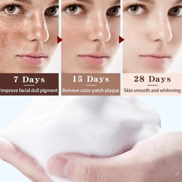 SOUTHERN RI™ Whitening Freckle Removal Cleanser - Image 3