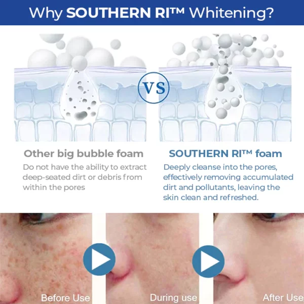 SOUTHERN RI™ Whitening Freckle Removal Cleanser - Image 5