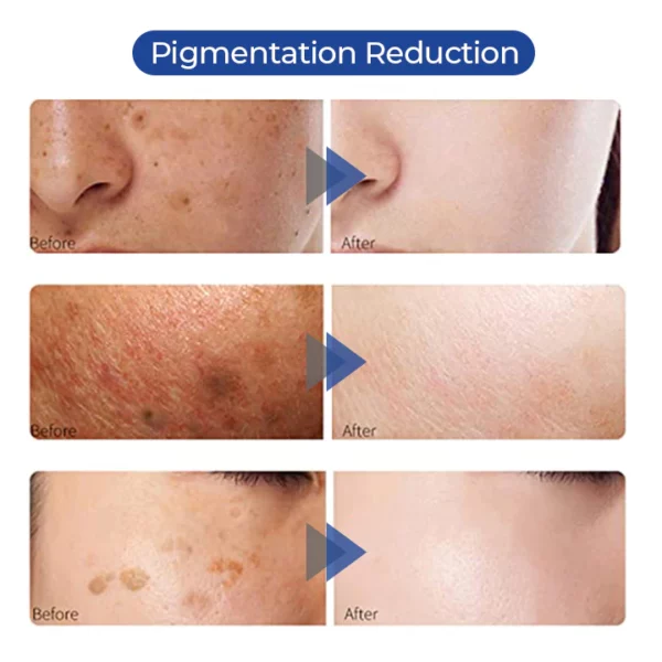 SOUTHERN RI™ Whitening Freckle Removal Cleanser - Image 8