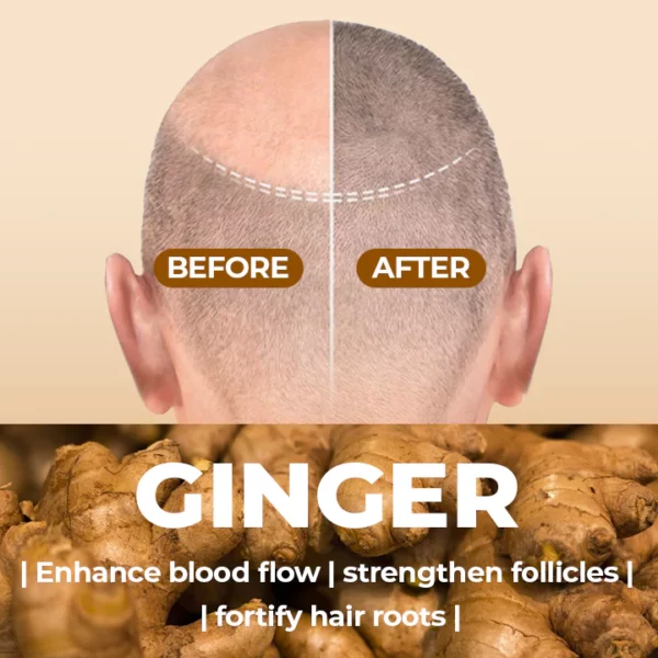 SalonX™ Natural Ginger Hair Growth Shampoo Bar - Image 3