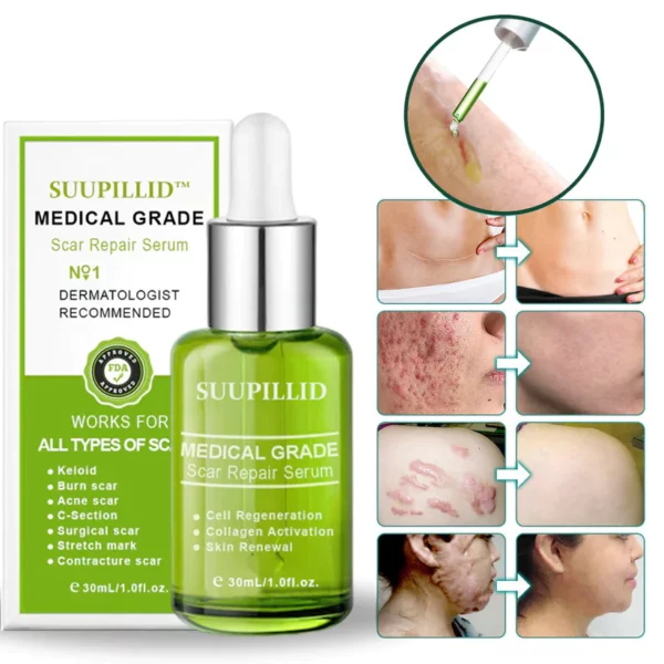 Suupillid™ Advanced Scar Repair Serum - Image 2