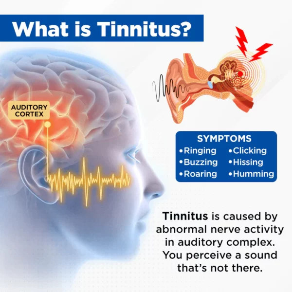 Suupillid™ AuriCalm Tinnitus Relief Device - Image 3