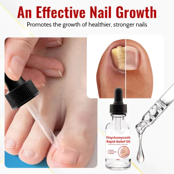 Suupillid™ Japanese NailRenew Onychomycosis Rapid Relief Oil - Image 3