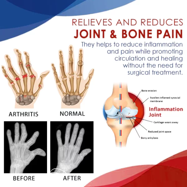 TherapyX™ Joint and Bone Therapy Gel