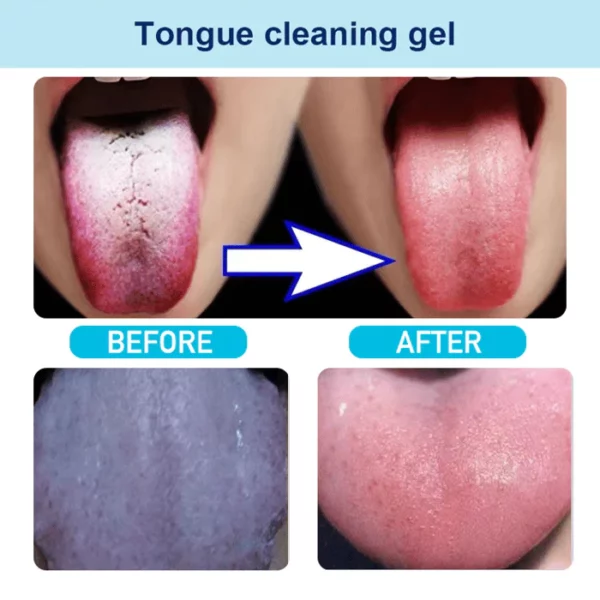 Tongue Cleaning Gel Set