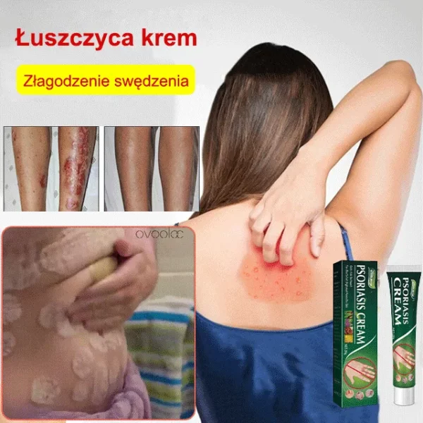 Universal Intense Psoriasis Skin Cream - Image 2