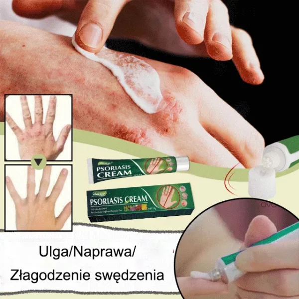 Universal Intense Psoriasis Skin Cream - Image 3