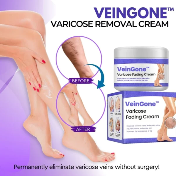 VeinGone™ Varicose Fading Cream - Image 2