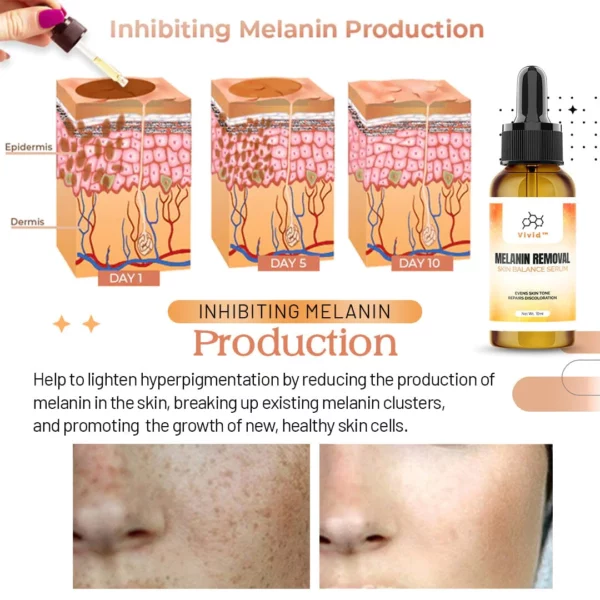 Vivid™ Melanin Removal Skin Balance Serum - Image 5