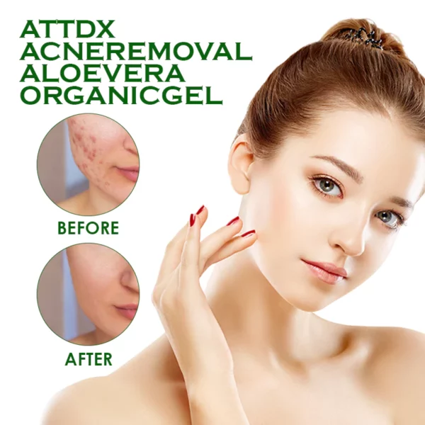 ATTDX AcneRemoval AloeVera OrganicGel - Image 8