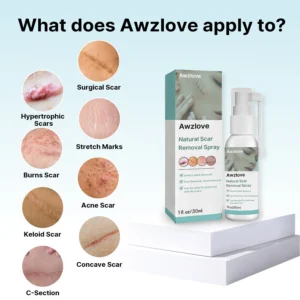 Awzlove™ Natural Advanced Scar Spray